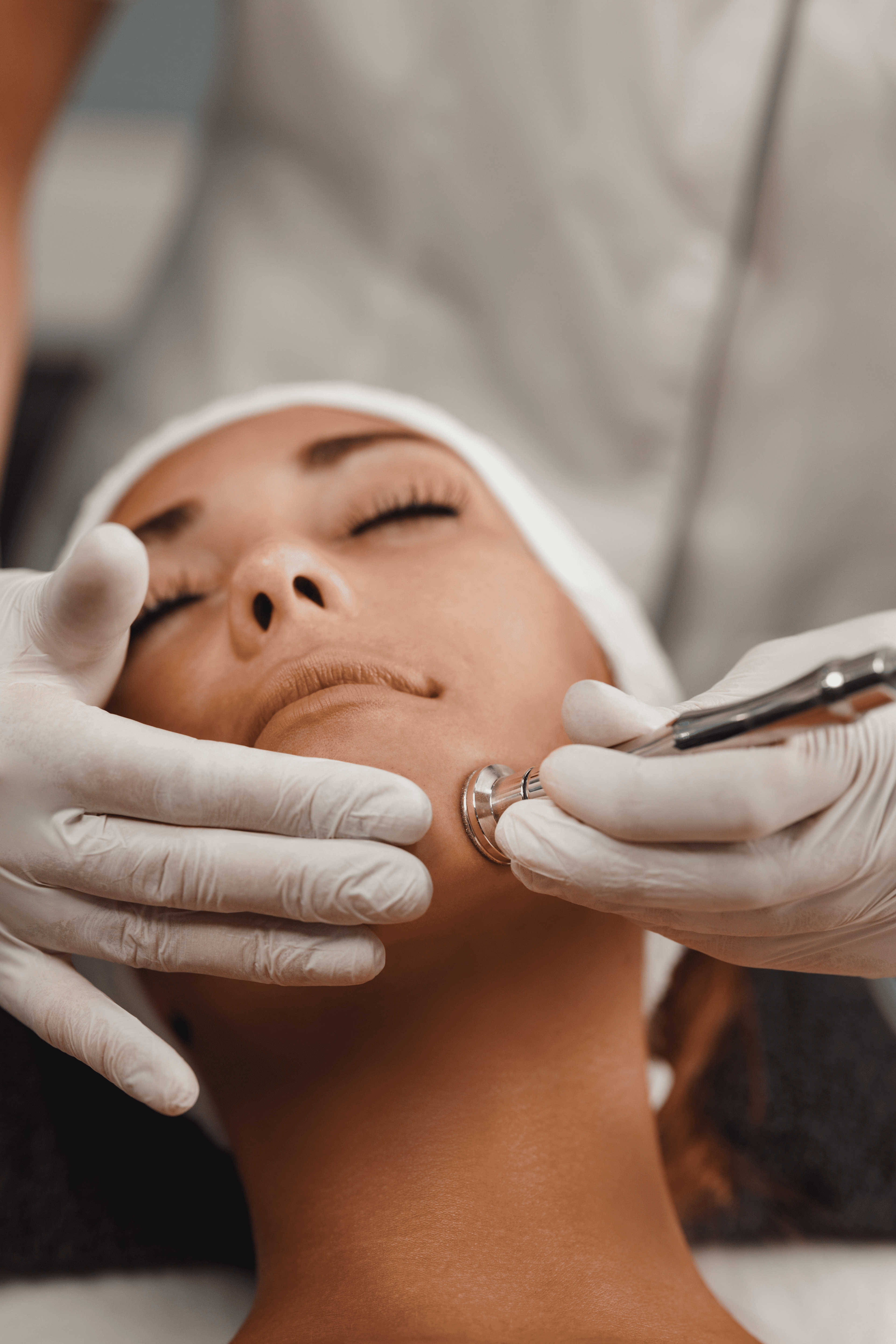 Microdermabrasion