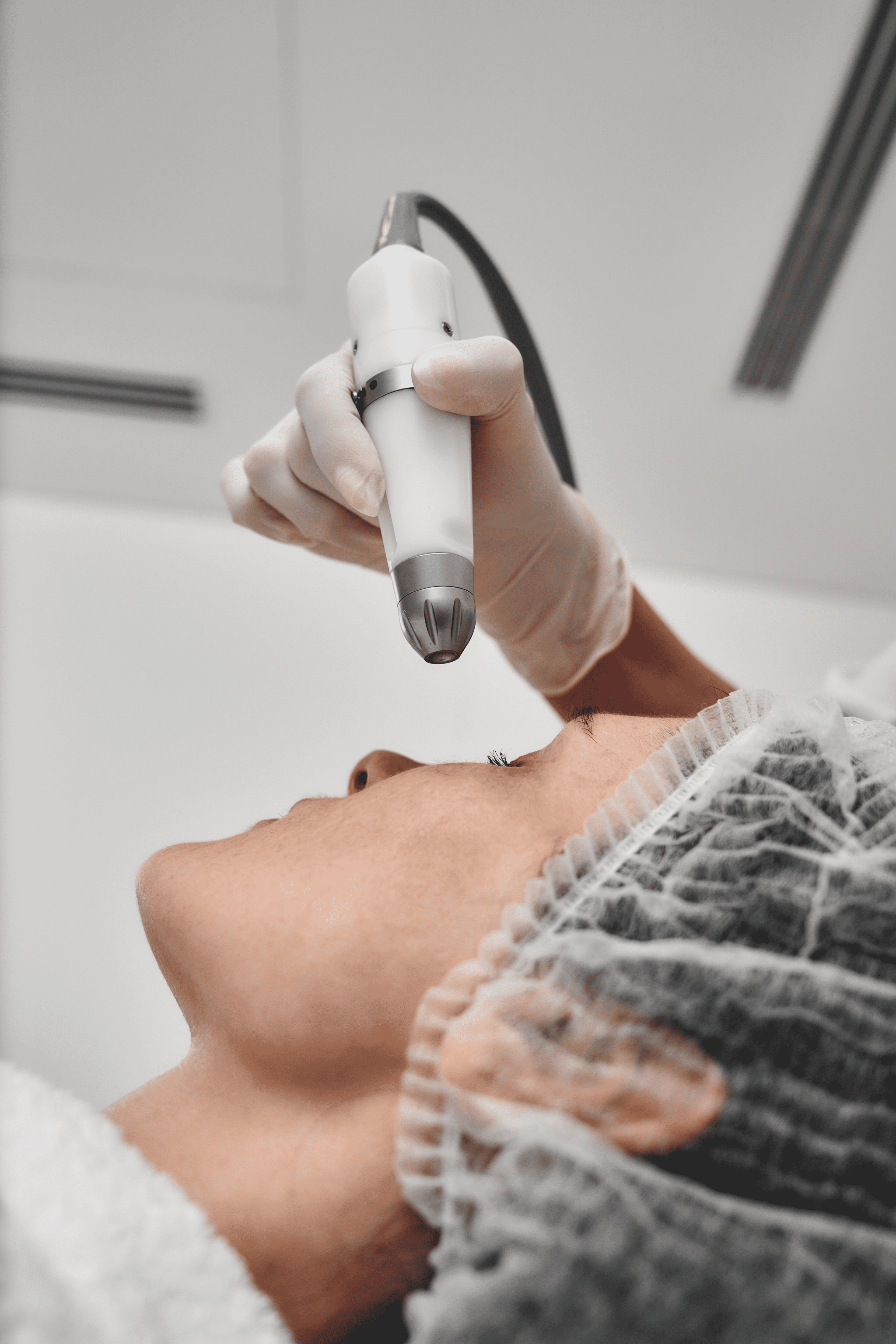 Microneedling 3 Sessions